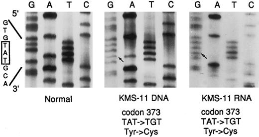 Fig. 7. Direct DNA sequencing of the FGFR3 mutation in the KMS-11 cell line. The 3′ primer used for the amplification of the TM-containing fragments of the FGFR3 gene was used as sequencing primer for both the DNA (164 bp) and cDNA (204 bp) templates (see Text). The normal sequence across codon 373 is reported. The base pair mutation is indicated by an arrow. DNA from normal peripheral blood leukocytes was used as a control (Normal).