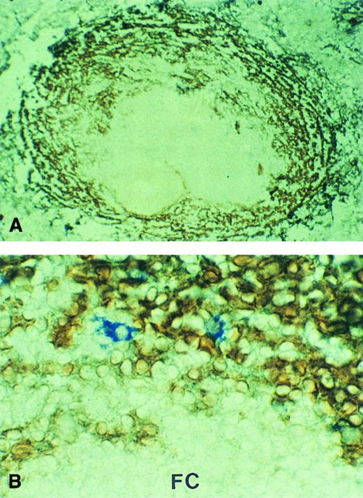 Fig. 2. MAdCAM-1 expression in the spleen involved by MALT lymphoma. Marginal zone sinuses surrounding the white pulp showed strong MAdCAM-1 expression (brown). (A) Case no. 3, low-power view; (B) case no. 4, in which the tumor cells were immunostained by the anti-idiotype (blue; high-power view). FC, follicle center.