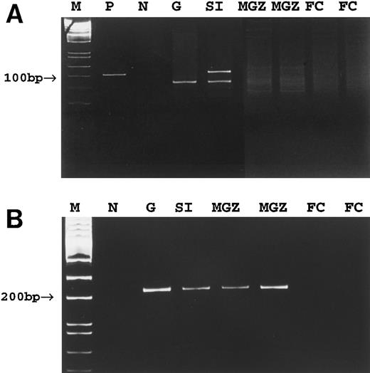 Fig. 4. PCR detection of tumor clone in case no. 4. (A) Conventional PCR using consensus Fr3 and JH primers. (B) Tumor clone-specific PCR. M, molecular weight marker; P, positive control; N, negative control; G, gastric tumor; SI, small intestinal tumor; MGZ, microdissected cells from the marginal zone; FC, microdissected cells from the follicle center.