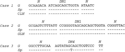 Fig. 5. Comparison of VDJ sequences between gastric tumor, lymph node, and spleen lesions in cases no. 1 through 3. N and D regions are indicated. G, gastric tumor; Sp, spleen; CLN, cervical lymph node; GLN, gastric lymph node.