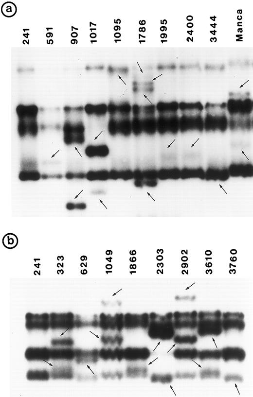 Fig. 1. PCR-SSCP pattern of mutant P53 allele in B-NHL. Tumor genomic DNA was amplified with exon-specific primers and electrophoresed through nondenaturing polyacrylamide gels. (a) Exon 5, (b) exon 6, (c) exon 7, and (d) exon 8. Nongermline bands identified by arrows.