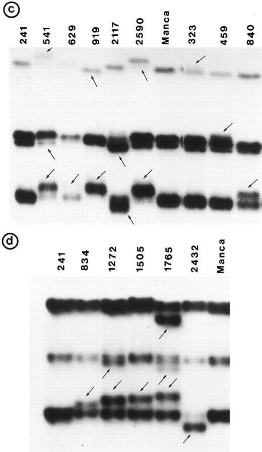 Fig. 1. PCR-SSCP pattern of mutant P53 allele in B-NHL. Tumor genomic DNA was amplified with exon-specific primers and electrophoresed through nondenaturing polyacrylamide gels. (a) Exon 5, (b) exon 6, (c) exon 7, and (d) exon 8. Nongermline bands identified by arrows.