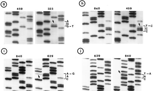 Fig. 2. Nucleotide sequence of representative mutant P53 alleles. DNA from tumors scored positive on PCR-SSCP analysis were further characterized by nucleotide sequencing of both DNA strands. (a and b) Structural changes in exon 5. PCR product from these tumors was cloned into a TA-vector from which normal and mutant alleles were isolated and sequenced. Tumor no. 907 had a deletion and no. 1095 had a duplication. / (c, d, e, and f) Representative point mutations in exon 6. (g, h, i, and j) Representative point mutations in exon 7. PCR-amplified DNA from these tumors was sequenced directly. Note that both homologs of chromosome 17 were cytogenetically normal in nos. 323, 1095, and 1866; 1 copy of 17p was lost in nos. 459, 840, and 905; status of chromosome 17 was not known in nos. 629 and 2303.