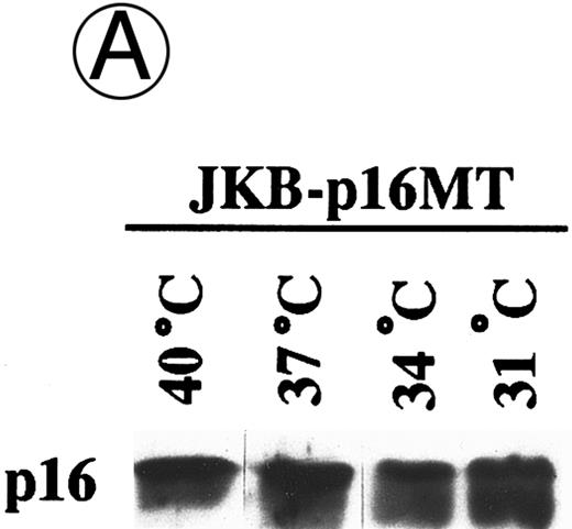 Fig. 3. Effects of culture temperature on p16 protein expression, p16 binding to CDK4 and CDK6, CDK4 and CDK6 kinase activities, and phosphorylation of pRB in JKB p16MT cells. JKB p16MT cells, JKB p16 WT cells, and JKB p16 control cells were cultured under varying temperatures (40°C, 37°C, 34°C, and 31°C) for 1 day. (A) Total lysates of JKB p16MT cells were immunoprecipitated with anti-p16 MoAb and immunoblotted with the same MoAb. Total lysates of JKB p16MT cells (B) or JKB p16WT cells (C) were immunoprecipitated with anti-CDK2, anti-CDK4, or anti-CDK6 Abs and immunoblotted with anti-p16 MoAb. (D) Total lysates of JKB p16MT cells and JKB control cells were immunoprecipitated with anti-CDK4 or anti-CDK6 Abs. GST-RB fusion protein was used as substrate in assays of kinase activities of CDK4- or CDK6-associated immune complexes. (E) Total lysates of JKB p16MT cells and JKB control cells were immunoprecipitated with anti-pRB MoAb (Ab-1) and immunoblotted with anti-pRB MoAb (Ab-6).