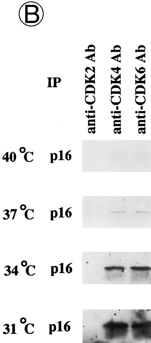 Fig. 3. Effects of culture temperature on p16 protein expression, p16 binding to CDK4 and CDK6, CDK4 and CDK6 kinase activities, and phosphorylation of pRB in JKB p16MT cells. JKB p16MT cells, JKB p16 WT cells, and JKB p16 control cells were cultured under varying temperatures (40°C, 37°C, 34°C, and 31°C) for 1 day. (A) Total lysates of JKB p16MT cells were immunoprecipitated with anti-p16 MoAb and immunoblotted with the same MoAb. Total lysates of JKB p16MT cells (B) or JKB p16WT cells (C) were immunoprecipitated with anti-CDK2, anti-CDK4, or anti-CDK6 Abs and immunoblotted with anti-p16 MoAb. (D) Total lysates of JKB p16MT cells and JKB control cells were immunoprecipitated with anti-CDK4 or anti-CDK6 Abs. GST-RB fusion protein was used as substrate in assays of kinase activities of CDK4- or CDK6-associated immune complexes. (E) Total lysates of JKB p16MT cells and JKB control cells were immunoprecipitated with anti-pRB MoAb (Ab-1) and immunoblotted with anti-pRB MoAb (Ab-6).
