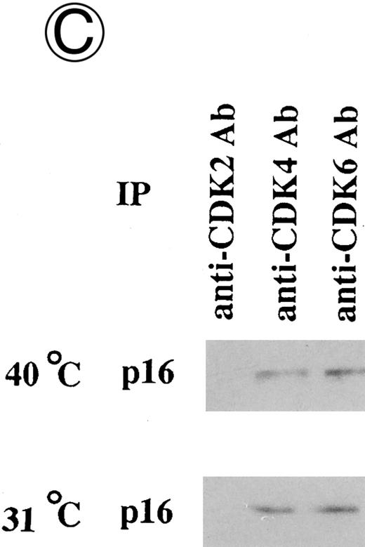 Fig. 3. Effects of culture temperature on p16 protein expression, p16 binding to CDK4 and CDK6, CDK4 and CDK6 kinase activities, and phosphorylation of pRB in JKB p16MT cells. JKB p16MT cells, JKB p16 WT cells, and JKB p16 control cells were cultured under varying temperatures (40°C, 37°C, 34°C, and 31°C) for 1 day. (A) Total lysates of JKB p16MT cells were immunoprecipitated with anti-p16 MoAb and immunoblotted with the same MoAb. Total lysates of JKB p16MT cells (B) or JKB p16WT cells (C) were immunoprecipitated with anti-CDK2, anti-CDK4, or anti-CDK6 Abs and immunoblotted with anti-p16 MoAb. (D) Total lysates of JKB p16MT cells and JKB control cells were immunoprecipitated with anti-CDK4 or anti-CDK6 Abs. GST-RB fusion protein was used as substrate in assays of kinase activities of CDK4- or CDK6-associated immune complexes. (E) Total lysates of JKB p16MT cells and JKB control cells were immunoprecipitated with anti-pRB MoAb (Ab-1) and immunoblotted with anti-pRB MoAb (Ab-6).