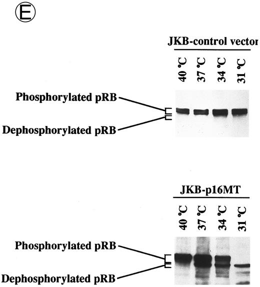 Fig. 3. Effects of culture temperature on p16 protein expression, p16 binding to CDK4 and CDK6, CDK4 and CDK6 kinase activities, and phosphorylation of pRB in JKB p16MT cells. JKB p16MT cells, JKB p16 WT cells, and JKB p16 control cells were cultured under varying temperatures (40°C, 37°C, 34°C, and 31°C) for 1 day. (A) Total lysates of JKB p16MT cells were immunoprecipitated with anti-p16 MoAb and immunoblotted with the same MoAb. Total lysates of JKB p16MT cells (B) or JKB p16WT cells (C) were immunoprecipitated with anti-CDK2, anti-CDK4, or anti-CDK6 Abs and immunoblotted with anti-p16 MoAb. (D) Total lysates of JKB p16MT cells and JKB control cells were immunoprecipitated with anti-CDK4 or anti-CDK6 Abs. GST-RB fusion protein was used as substrate in assays of kinase activities of CDK4- or CDK6-associated immune complexes. (E) Total lysates of JKB p16MT cells and JKB control cells were immunoprecipitated with anti-pRB MoAb (Ab-1) and immunoblotted with anti-pRB MoAb (Ab-6).