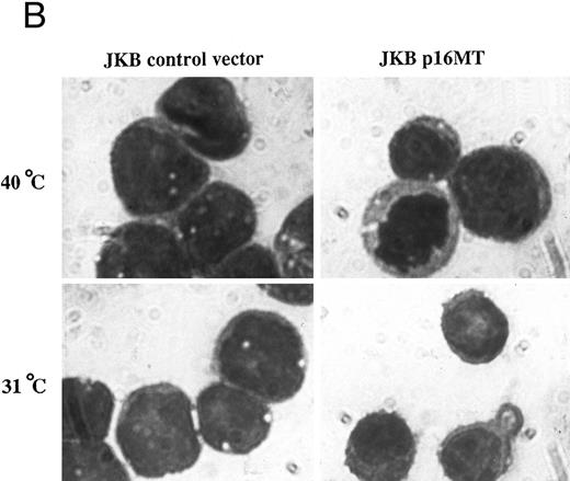 Fig. 4. Effects of cell culture temperature on viable cell number, morphology, and cell surface phenotype of JKB p16MT cells. (A) JKB p16MT cells were cultured under the following conditions: 40°C for 7 days (□); 31°C for 7 days (▪); 31°C for 1 day, then 40°C for 6 days (○); 31°C for 2 days, then 40°C for 5 days (⊞); 31°C for 3 days, then 40°C for 4 days (×); and 31°C for 4 days, then 40°C for 3 days, ( — ▴ — ). JKB control cells were cultured at either 40°C (▵) or 31°C (•) for 7 days. Viable cell number was assessed using trypan blue staining. (B) JKB control (left) and JKB p16MT cells (right) were cultured at 40°C (upper) or 31°C (lower) for 7 days. Cell cytosmears were stained with Wright-Giemsa solution. / (C) JKB control (left) and JKB p16MT (right) cells were cultured at 40°C (upper) or 31°C (lower) for 7 days. Cell surface phenotype was determined by flow cytometric analysis.
