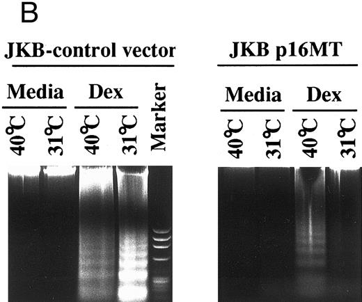 Fig. 5. Effects of cell culture temperature on susceptibility of JKB p16MT cells to apoptosis triggered by dexamethasone. JKB control (▪) and JKB p16MT (□) cells were cultured for 1 day at 40°C; JKB control (▨) or JKB p16MT (▤) were also cultured for 1 day at 31°C. Cells were then cultured for 1 day with Dex (10 μmol/L) at either temperature to induce apoptosis. The percentage of apoptotic cells was determined by acridine orange/ethidium bromide staining (A) and DNA fragmentation (B).