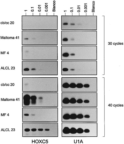 Fig. 2. Results of a semiquantitative RT-PCR for HOXC5 (left panels) and control gene U1A (right panels) on a serial dilution of total RNA (1, 0.1, 0.01, and 0.001 μg) from a centroblastic/centrocytic (cb/cc) lymphoma (case no. 20), a maltoma (case no. 41), an MF (case no. 4), and an ALCL (case no. 23). PCR results performing 30 cycles (upper panels) and 40 cycles (lower panels) are shown. Note that signals for HOXC5 in the maltoma and ALCL are visible after less PCR cycles and at higher dilutions than those in the cb/cc and the MF. Very weak bands for HOXC5 in the first dilution of cb/cc, the third dilution of maltoma after 30 cycles, and the fourth dilution of the maltoma after 40 cycles are not visible in the figure, but are present on the films.