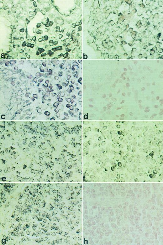 Fig. 3. RISH analysis of HOXC4, HOXC5, and HOXC6 on a maltoma (a through d) and an immunocytoma (e through h). HOXC4 expression is shown in (a) and (e), HOXC5 in (b) and (f ), HOXC6 in (c) and (g), and sense control for HOXC5 in (d) and (h). Positive signals are shown as black DAB/Ni precipitates (a) or as black silver granules (e).