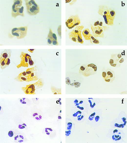Fig. 2. Immunocytochemical reaction for MPO in neutrophils from a normal subject (a and b) and the MPO deficient subjects DP (c and d) and MP (e and f). (a), (c), and (e), anti-MPO antiserum. (b), (d), and (f), anti-MPO MoAb MPO-3.