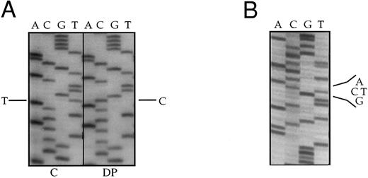 Fig. 3. Nucleotide direct sequences of MPO cDNA (A) and MPO exon 6 (B) from the MPO deficient subject DP. cDNA direct sequence shows the T929C substitution in DP (A, DP). cDNA direct sequence from a normal subject is also shown (A, C). Direct sequence of MPO exon 6 from DP shows the simultaneous presence of C and T bases in position 929.