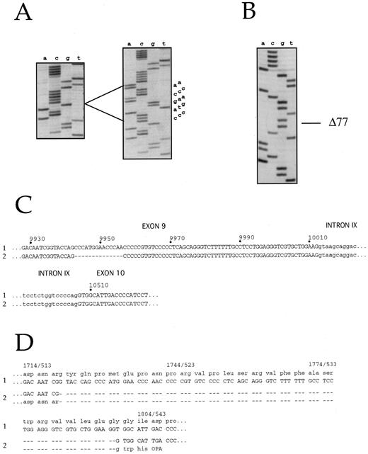 Fig. 4. Nucleotide sequences of MPO exon 9-10 clones (A and C) and of cDNA clones from the MPO-deficient subject MP (B and D). (A) < include the 14-base deletion, whose sequence is reported. (B) Δ77 shows the position of the 77-base deletion. (C) Upper case, exon 9 and exon 10. Lower case, intron IX; 1 — normal sequence, 2 — 14-base deleted sequence. (D) Nucleotide and deduced aminoacidic sequences of normal allele (1) and of 77-base deleted allele (2). Dots, deleted bases, or deleted amino acids.