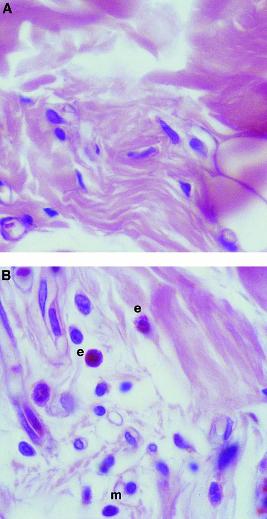 Fig. 3. Histologic analysis of rat skin sites injected with TNFα. Skin sites were injected with (A) Tyrode or (B) TNFα (10−11 mol/site). After a 4-hour in vivo test period, the skin sites were processed and stained as described in the Materials and Methods. In photomicrographs, examples of eosinophils and mononuclear cells are labeled e and m, respectively. Original magnification × 600.