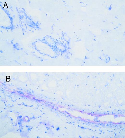 Fig. 7. Effect of intradermal TNFα on VCAM-1 expression in rat skin microvasculature. Tyrode or TNFα (10−11 mol/site) was ID injected into the back skin of the animal. Photomicrographs show VCAM-1 expression (red staining) in Tyrode-injected (A) or TNFα-injected sites (B) after a 4-hour in vivo test period. Original magnification × 200.