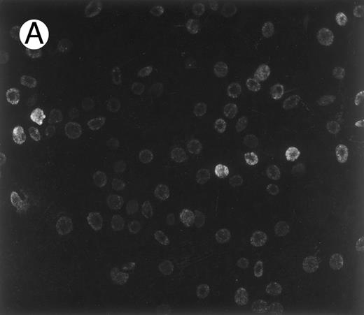 Fig. 1. Immunofluorescence staining of sickle cells by an antibody to an adhesive band 3 sequence in malaria infected cells. Sickle cells (A) and normal cells (B) were immunostained with monoclonal antibody (1F4) prepared against peptide 3d (band 3 residues 547-553), which inhibits cytoadherence in malaria infected cells.15 (C) Control immunostaining of sickle cells in the absence of primary antibody, 1F4.