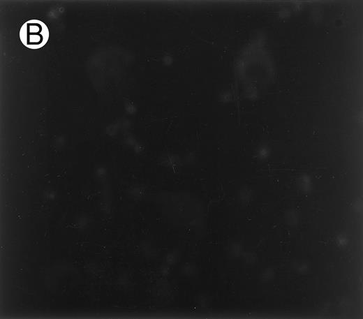 Fig. 1. Immunofluorescence staining of sickle cells by an antibody to an adhesive band 3 sequence in malaria infected cells. Sickle cells (A) and normal cells (B) were immunostained with monoclonal antibody (1F4) prepared against peptide 3d (band 3 residues 547-553), which inhibits cytoadherence in malaria infected cells.15 (C) Control immunostaining of sickle cells in the absence of primary antibody, 1F4.
