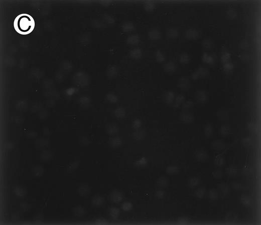 Fig. 1. Immunofluorescence staining of sickle cells by an antibody to an adhesive band 3 sequence in malaria infected cells. Sickle cells (A) and normal cells (B) were immunostained with monoclonal antibody (1F4) prepared against peptide 3d (band 3 residues 547-553), which inhibits cytoadherence in malaria infected cells.15 (C) Control immunostaining of sickle cells in the absence of primary antibody, 1F4.
