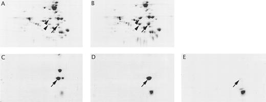 Fig. 6. 2D gels of tryptic peptides from spectrin dimers and α dimerization site recombinant peptides. Isofocusing was in the horizontal direction (basic side on the left) followed by separation on a 12% SDS gel that was stained with Coomassie Brilliant Blue. (A) Two hundred micrograms of spectrin digested with trypsin from a normal donor; (B) 200 μg of spectrin digested with trypsin from a donor homozygous for the αLELY mutation; (C through E) 20 μg of each recombinant spectrin peptide digested with trypsin. (C) α18-21; (D) α18-211857; (E) α18-211857-Δ46. Arrows indicate the position of the normal αV 41-kD tryptic domain in all panels. The arrowheads indicate the major αIV domain peptides in (A) and (B).