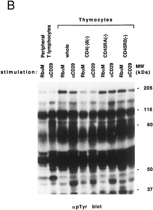 Fig. 3. Induction of tyrosine phosphorylation through VLA/β1-stimulation. (A) Induction of several proteins' tyrosine phosphorylation in peripheral lymphocytes from two normal controls (C 1 and 2) and 4 patients (PN 1, 2, 3, and 4) 8 weeks to 2.5 years after allo-BMT. Monocyte-depleted lymphocytes were incubated on plates coated using rabbit antimouse IgG with (+) or without (−) 4B4 (5 μg/mL) for 30 minutes, and then lysed. Whole cell lysate (50 μg/lane) was immediately subjected to Western blotting with the anti-phosphotyrosine MoAb. Autoradiography was carried out for 14 to 18 hours. Normal control samples were analyzed at the same time in each experiment, which constantly demonstrated similar tyrosine phosphorylation pattern to Ct1 and Ct2 (data not shown). Representative results at each stage after allo-BMT from different membranes are shown. (B) Whole thymocytes and immunodepleted thymocytes using anti-CD4 (19Thy) plus anti-CD8 (21Thy). Anti-CD45RA (2H4) or anti-CD45RO (UCHL1) antibody were incubated on plates coated with rabbit antimouse IgG (RbαM) or rabbit antimouse IgG plus anti-CD29 antibody (4B4; 5 μg/mL) for 30 minutes, lysed, and detected by anti-pTyr blot by the same method as above.