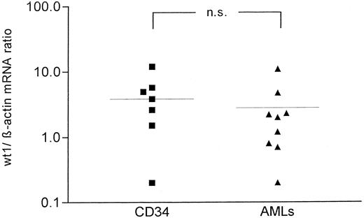 Fig. 3. wt1/β-actin ratio of CD34+ normal progenitors (left) versus AML blasts (right). The difference in wt1/β-actin ratio was not significant (P = .21).