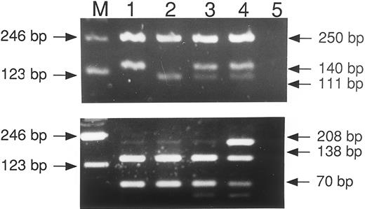 Fig. 1. Detection of the HLA-H Cys282Tyr and His63Asp mutations by PCR-RFLP. The top panel shows the result of PCR with the codon 282 primers and restriction digest by Rsa I. The bottom panel is PCR product obtained with the codon 63 primers and digested with Bcl I. The patients are as follows: track 1, normal; track 2, homozygous mutant, codon 282; normal, codon 63; track 3, heterozygous mutant, codon 282; normal codon 63; track 4, compound heterozygote; track 5, water negative control.