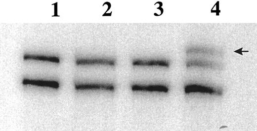 Fig. 2. RT-PCR SSCP analysis of the Fas antigen in myeloma patient BM specimens. 32P-labeled PCR products are separated on a 6% acrylamide (49.5:0.5 bis) gel. Lane 1, PBLs; lane 2, 8226; lane 3, BAKA27 (normal); lane 4, FOSM32. Arrow indicates band excised for sequence analysis.