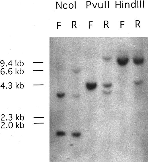 Fig. 1. Southern blot analysis of DNA from the patient at first diagnosis (F) and at relapse phase (R) carrying the additional (5; 14)(q33; q32) translocation. Genomic DNA samples (5 μg each) were digested with Nco I, PvuII, and HindIII. Hybridization with probe Patients, a DNA fragment from PDGFRβ, shows DNA rearrangements in relapse phase. One rearranged band was detected upon Nco I and HindIII digestion and two rearranged bands were observed after PvuII digestion. The sizes of HindIII digested λ DNA markers are shown on the left of the panel.