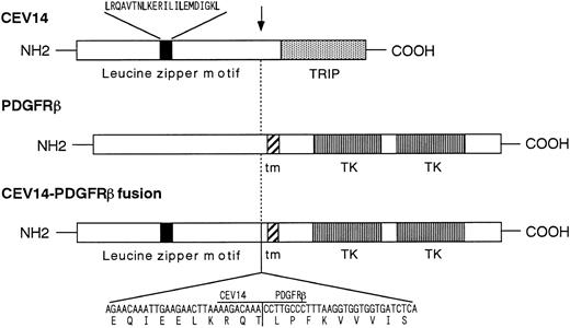 Fig. 3. Schematic of the CEV14-PDGFRβ fusion protein. The nucleotide and deduced amino acids sequences near the breakpoint of the CEV14-PDGFRβ fusion are shown at the bottom of the figure. The breakpoint is indicated by an arrow. CEV14 has a leucine zipper motif 5′ of the breakpoint. TRIP indicates the predictive thyroid hormone receptor interacting domain. The PDGFRβ split tyrosine kinase domain is shown. tm indicates transmembrane domain.