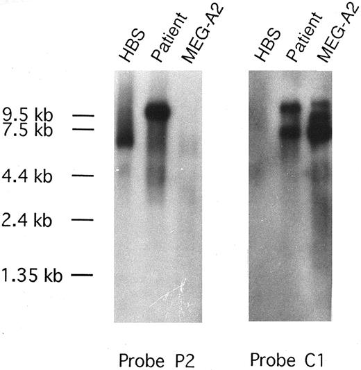 Fig. 4. Northern blot analysis of the CEV14-PDGFRβ transcript. The PDGFRβ probe P2, located 3′ of the translocation breakpoint, detects wild-type 5.7-kb and 4.8-kb PDGFRβ transcripts in human BM stroma (HBS), while a novel 10-kb transcript is seen in the patient's leukemia cells with the t(5; 14) translocation. CEV14 probe C1 detects the same 10-kb transcript and one of the major CEV14 transcripts, while 10.5-kb, 9.0-kb, and 7.0-kb CEV14-specific transcripts are expressed in MEG-A2 cells.