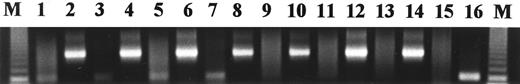 Fig. 2. Agarose gel of representative PCR results on fresh BM core biopsy samples. KS330233 is amplified from the DNA from patients with myeloma (lanes 1, 3, 5, and 7), but not from normal individuals (lanes 9, 11, and 13). Even-numbered lanes represent the β-actin controls (650 bp product) for each of the preceding odd-numbered lanes, respectively. Placental DNA is the negative control (lane 15), and DNA from the KSHV-infected cell line KS-1 is the positive control (lane 16). M, 123-bp molecular-weight marker.