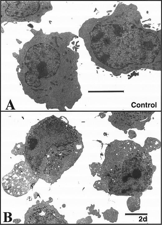 Fig. 2. K562 cells treated with 17 μmol/L etoposide for 1 hour undergo delayed apoptosis. (A and B) Electron micrographs of K562 cells before (A) and 48 hours after (B) a 1-hour treatment with 17 μmol/L etoposide. Bar, 2 μm. (C and D) Samples of HL-60 cells (lanes 1, 2) and K562 cells (lanes 3 through 8) were treated with 17 μmol/L etoposide for 0 hours (lanes 1 and 3) or 1 hour (lanes 2 and 4 through 8) and incubated in drug-free medium thereafter. At the indicated times, samples were obtained and subjected to SDS-PAGE followed by immunoblotting with monoclonal anti-PARP (C) or agarose gel electrophoresis (D). (E) Total cell number of K562 cells following a 1-hour exposure to 17 μmol/L etoposide and cell-cycle distribution of the resulting nonapoptotic cells. (Inset) DNA histograms obtained before and 1 day after a 1-hour exposure of K562 cells to 17 μmol/L etoposide. (F) Percentage of K562 cells that exhibit apoptotic morphology and trypan blue uptake after a 1-hour exposure to 17 μmol/L etoposide. (Inset) Photograph of K562 cells stained with 1 μg/mL Hoechst 33342 at the indicated time after a 1-hour etoposide treatment. Arrows, cells with chromatin condensation and nuclear fragmentation indicative of apoptosis. Each panel is representative of at least three experiments.