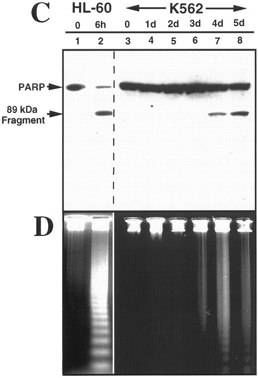 Fig. 2. K562 cells treated with 17 μmol/L etoposide for 1 hour undergo delayed apoptosis. (A and B) Electron micrographs of K562 cells before (A) and 48 hours after (B) a 1-hour treatment with 17 μmol/L etoposide. Bar, 2 μm. (C and D) Samples of HL-60 cells (lanes 1, 2) and K562 cells (lanes 3 through 8) were treated with 17 μmol/L etoposide for 0 hours (lanes 1 and 3) or 1 hour (lanes 2 and 4 through 8) and incubated in drug-free medium thereafter. At the indicated times, samples were obtained and subjected to SDS-PAGE followed by immunoblotting with monoclonal anti-PARP (C) or agarose gel electrophoresis (D). (E) Total cell number of K562 cells following a 1-hour exposure to 17 μmol/L etoposide and cell-cycle distribution of the resulting nonapoptotic cells. (Inset) DNA histograms obtained before and 1 day after a 1-hour exposure of K562 cells to 17 μmol/L etoposide. (F) Percentage of K562 cells that exhibit apoptotic morphology and trypan blue uptake after a 1-hour exposure to 17 μmol/L etoposide. (Inset) Photograph of K562 cells stained with 1 μg/mL Hoechst 33342 at the indicated time after a 1-hour etoposide treatment. Arrows, cells with chromatin condensation and nuclear fragmentation indicative of apoptosis. Each panel is representative of at least three experiments.