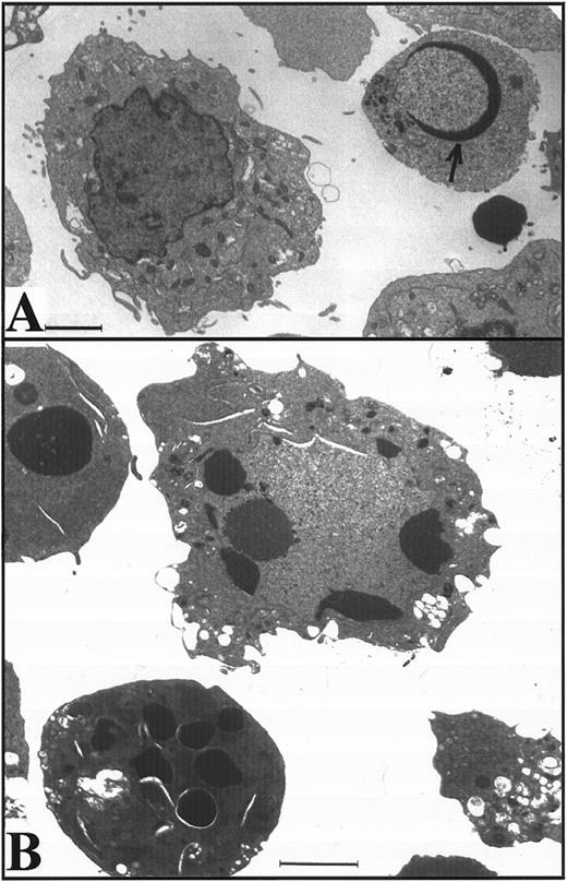 Fig. 3. Apoptosis in K562 cells treated continuously with 68 μmol/L etoposide. (A and B) Morphology of K562 cells after 24 hours (A) and 48 hours (B) continuous exposure to etoposide. Arrow in (A), peripheral chromatin condensation in K562 cell after 24-hour etoposide exposure. Bar, 2 μm. (C and D) HL-60 cells treated with etoposide for 0 to 6 hours (lanes 1 through 6) and K562 cells treated with etoposide for 0 to 48 hours (lanes 7 through 10) were harvested for agarose gel electrophoresis (C) and SDS-PAGE followed by blotting with C-2-10 anti-PARP or polyclonal anti-lamin B1 antibodies (D). Arrow indicates 89-kD cleavage product of PARP.