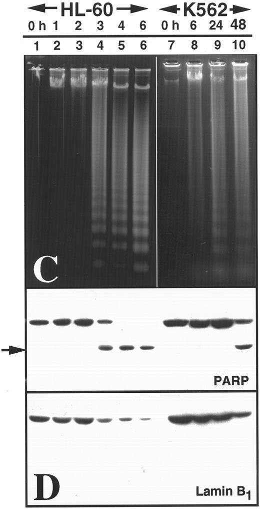 Fig. 3. Apoptosis in K562 cells treated continuously with 68 μmol/L etoposide. (A and B) Morphology of K562 cells after 24 hours (A) and 48 hours (B) continuous exposure to etoposide. Arrow in (A), peripheral chromatin condensation in K562 cell after 24-hour etoposide exposure. Bar, 2 μm. (C and D) HL-60 cells treated with etoposide for 0 to 6 hours (lanes 1 through 6) and K562 cells treated with etoposide for 0 to 48 hours (lanes 7 through 10) were harvested for agarose gel electrophoresis (C) and SDS-PAGE followed by blotting with C-2-10 anti-PARP or polyclonal anti-lamin B1 antibodies (D). Arrow indicates 89-kD cleavage product of PARP.