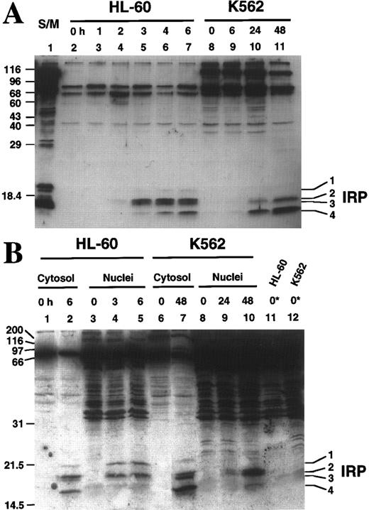 Fig. 6. Affinity labeling of etoposide-treated HL-60 and K562 cytosol and nuclei. (A) Aliquots containing 37 μg of cytosolic protein prepared from HL-60 (lanes 2 through 7) or K562 (lanes 8 through 11) cells treated with 68 μmol/L etoposide for the indicated length of time were reacted with z-EK(bio)D-aomk, subjected to SDS-PAGE, and reacted with peroxidase-coupled streptavidin. Additional experiments (see B) indicate that bands detected in 0-hour samples bind streptavidin in the absence of reaction with z-EK(bio)D-aomk. Lane 1, apoptosis-inducing S/M extract prepared from DU249 chicken hepatoma cells.2453 (B) z-EK(bio)D-aomk labeling of cytosol and nuclei from HL-60 cells and K562 cells treated with 68 μmol/L etoposide for the indicated length of time. Samples containing cytosol or nuclei from 3 × 106 cells were incubated with 1 μmol/L z-EK(bio)D-aomk for 1 hour, then subjected to SDS-PAGE and blotting as described in the legend for (A). Lanes marked 0* contain nuclei that were subjected to SDS-PAGE without z-EK(bio)D-aomk treatment, thereby revealing the streptavidin-binding polypeptides that are normal constituents of these nuclei.