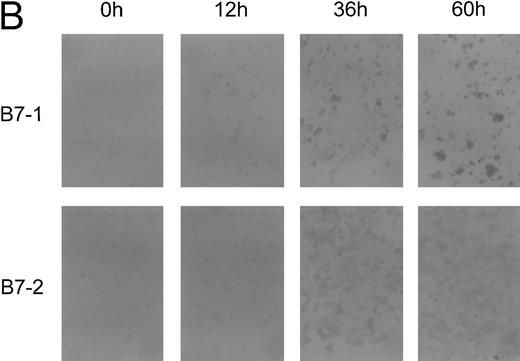 Fig. 3. Time course of APC capacity and cell-surface expression of costimulatory molecules B7-1 and B7-2 on follicular lymphoma cells stimulated in vitro with CD40L and IL-4. Induction/upregulation of B7-1 and B7-2 was analyzed by FACS using directly conjugated MoAbs or by IC on cytospin preparations of the same cells. Cells were obtained from culture and extensively washed before analysis at time points indicated. (A) FACS analysis. Unshaded area indicates fluorescence of isotype-matched antibody. (B) IC of cytospin preparations. To detect differences in intensity by IC, primary antibodies were used at lower concentrations than described for Fig 2. B7-1 MoAb (EW3.4B2.C4) was used at a 1:2,000 dilution, B7-2 MoAb (HA5.2B7) at a 1:12,000 dilution. (C) Allogeneic T-cell proliferation induced by unstimulated FL cells and CD40-FL cells. FL cells were activated as described in Material and Methods, washed, irradiated, and used at 5 × 104 stimulator cells/well. Highly purified allogeneic T cells (1 × 105 cells/well) were used as responders. T-cell proliferation was measured at day 3 (data not shown) and day 6 by thymidine incorporation for the last 16 hours of the culture period. Approriate controls (T cells, FL cells, CD40-FL cells) were less than 1,800 cpm. One representative experiment (FL4, FL12, FL16) of three experiments is shown.