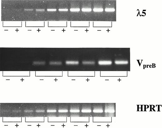 Fig. 4. λ5 and VpreB expression in CD19− and CD19+ cells generated in response to FL + IL-7. mRNA expression of λ5, VpreB , and HPRT (control) was investigated by RT-PCR on CD19− (−) and CD19+ (+) cells isolated by fluorescence-activated cell sorting (FACS) as described in the Materials and Methods. For all three genes, the PCR amplification was stopped at intervals of five cycles (starting at 15 cycles). The PCR products generated by using primers for λ5, VpreB , and HPRT, resulted in products of 371, 343, and 248 bp, respectively.