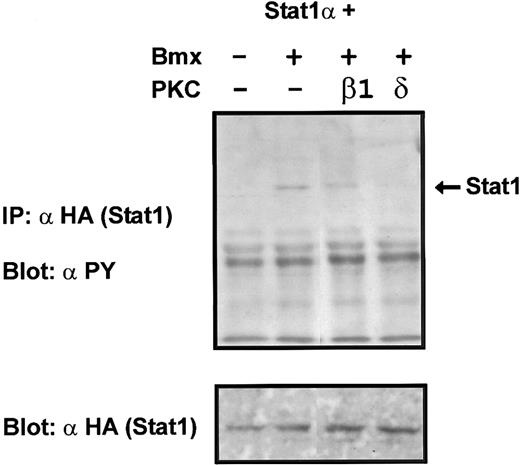Fig. 10. Coexpression of PKCδ inhibits Bmx-induced tyrosine phosphorylation of Stat1. Stat1α (4 μg) and Bmx (3 μg) expression vectors were transfected into COS cells together with the PKC vectors (4 μg). Stat1α was immunoprecipitated from cell lysates using anti-HA antibodies. The immunoprecipitates were separated in 7.5% SDS-PAGE, transferred to nitrocellulose membrane, and probed for anti-phosphotyrosine. Shown in the lower panel is an immunoblot from total cell lysates electrophoresed in 7.5% SDS-PAGE probed for Stat1α using anti-HA antibodies.