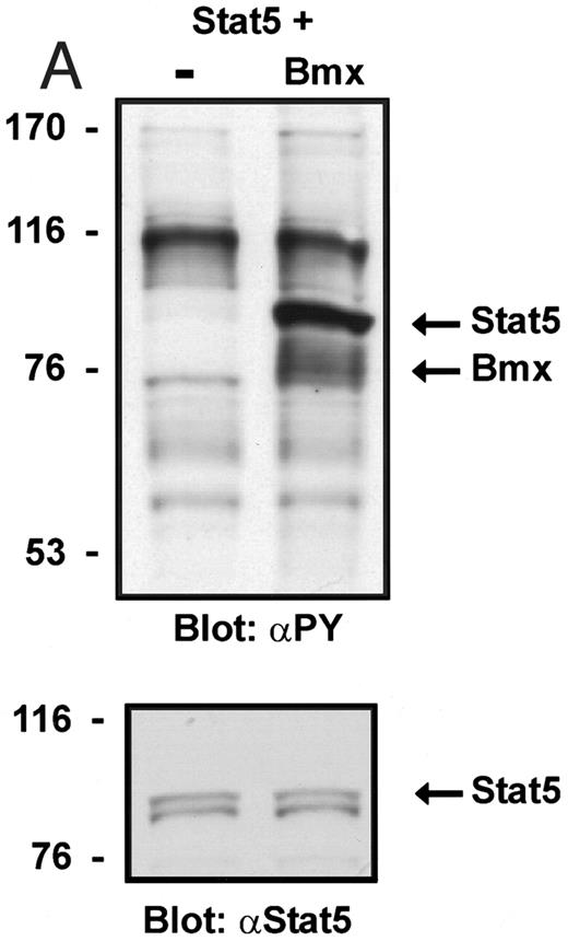 Fig. 3. Coexpression of Bmx induces activation of Stat5. (A) COS cells were transfected with Stat5 expression vector alone or together with Bmx-HA expression vector. Cell lysates were electrophoresed in 7.5% SDS-PAGE and Western immunoblotted with anti-Stat5 and anti-phosphotyrosine antibodies. (B) The same lysates were analyzed in a mobility shift assay using 32P-labeled oligonucleotide from the promoter of the β-casein gene. The lysates were also supershifted with anti-Stat5 antibody.