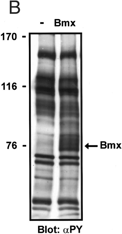 Fig. 6. Bmx does not phosphorylate endogenous Jak kinases. (A) 293T cells were transfected with Bmx-HA expression vector or left without transfection. Jak1 was immunoprecipitated from cell lysates using anti-Jak1 antibody and the immunoprecipitates were electrophoresed in 6% SDS-PAGE followed by Western immunoblotting using anti-Jak1 or anti-phosphotyrosine antibodies. The Ig heavy chains are indicated by an asterisk. (B) Total cell lysates were electrophoresed in 6% SDS-PAGE followed by Western immunoblotting with anti-phosphotyrosine antibodies.