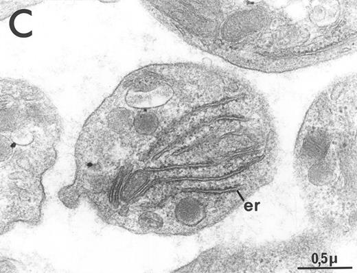 Fig. 6. Ultrastructure of circulating platelets from MPZenNeo (A) or MPZenTPO (B) reconstituted mice. db, dense body; er, endoplasmic reticulum; gly, glycogen. The figure emphasizes the abnormally large size of some platelets seen in MPZenTPO reconstituted mice. (C) Enlargement of a giant platelet showing a richness in glycogen and in endoplasmic reticulum. Platelet shape and ultrastructure did not reveal any signs of activation other than the rare occurrence of dense bodies in MPZenTPO platelets.