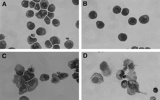 Fig. 2. sIL-11R induces differentiation of M1 cells in the presence of IL-11. May-Grünwald Giemsa Stain (×400 original magnification) of parental M1 cells after 5 days in liquid culture in the presence of (A) IL-11 500 pmol/L (B) sIL-11R 40 nmol/L (C) LIF 1,000 U/mL (D) IL-11 plus sIL-11R.