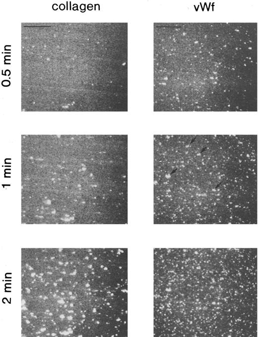 Fig. 2. Fluorescent images of platelets adhering to vWF-coated and collagen-coated surfaces. Mepacrine-treated blood was passed through the flow chamber at the shear rate of 800/s. Fluorescent patterns were captured at 0.5, 1, and 2 minutes after the start of flow. On the vWF-coated surface, platelets adhered mainly as single platelets, but some small aggregates were observed (arrows). Bars shown in the upper left corner in the top row indicate a length of 50 μm.