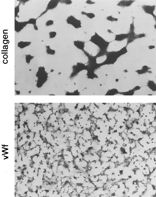 Fig. 5. Comparison of the morphology of platelets adhering to the collagen-coated surface and the vWF-coated surface (fixing adhesion method). Normal blood was circulated through the perfusion chamber for 5 minutes under a shear rate of 800/s, and adherent platelets were fixed, stained, and then observed by microscopy. The formation of large platelet aggregates was observed on the collagen-coated surface.