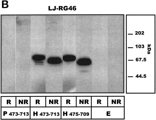 Fig. 3. Western blot analysis of COS-7 cell–expressed human and porcine vWF–A1-domain constructs under reducing (R) and nonreducing (NR) conditions. Preparations of COS-7 cells transfected with standard porcine (P473-713) and human (H473-713) constructs or a further truncated human (aa 475-709: H475-709) vWF-A1 construct as well as with empty vector (E) are shown. (A) Detecting antibody LJ-RG46 (mouse anti-human A1-domain MoAb). (B) Detecting antibody α-FLAG (mouse anti-FLAG MoAb).