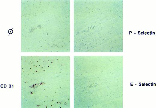 Fig. 1. Absence of E- and P-selectin on cerebral vessel endothelium during EAE in SJL/J mice. An inflammatory cuff in the spinal cord of a SJL/J mouse afflicted with acute EAE (day 14, clinical score +++) is shown. CD31/PECAM-1 is expressed by all cerebral endothelial cells. E- and P-selectin cannot be detected. ⊘; isotype matched control. Immunoperoxidase staining, hematoxylin counterstain; original magnification × 240.