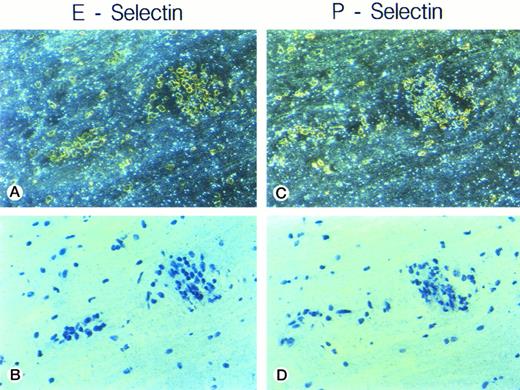 Fig. 2. In situ hybridization analysis of E-selectin and P-selectin mRNA expression in the spinal cord of a SJL/J mouse afflicted with acute EAE (day 14, clinical score +++) is shown. Neither E-selectin nor P-selectin mRNA can be detected. Vessels surrounded by inflammatory cuffs are shown, (a) and (c), dark field; (b) and (d), bright field. Sections are counterstained with toluidine blue. Original magnification × 480.