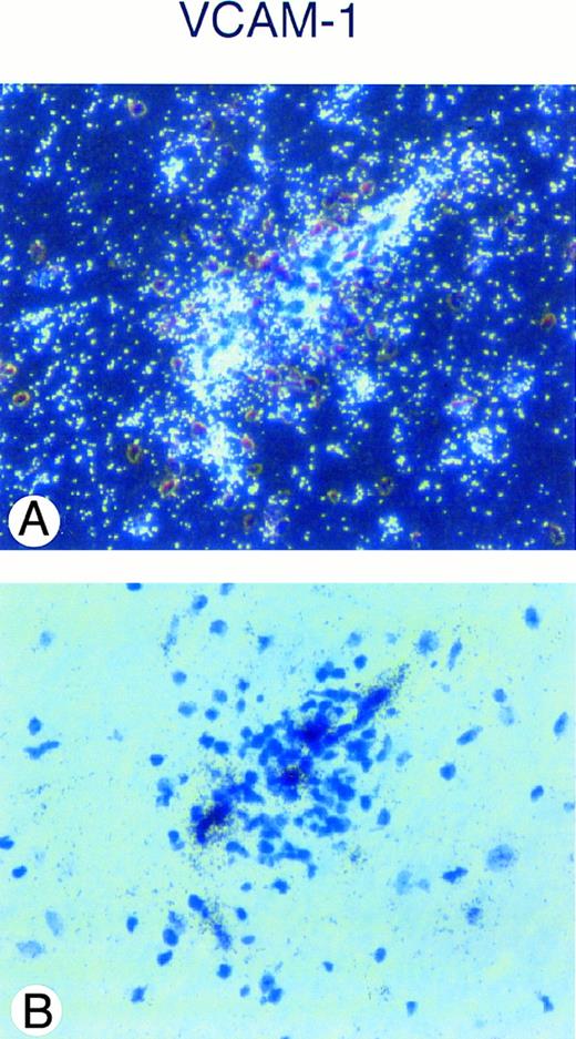 Fig. 3. In situ hybridization analysis of VCAM-1 mRNA expression in the spinal cord of a SJL/J mouse afflicted with acute EAE (day 14, clinical score +++) is shown. A strong hybridization signal for VCAM-1 mRNA can be detected in a vessel surrounded by an inflammatory cuff (A), dark field; (B), bright field. Sections are counterstained with toluidine blue. Original magnification × 480.